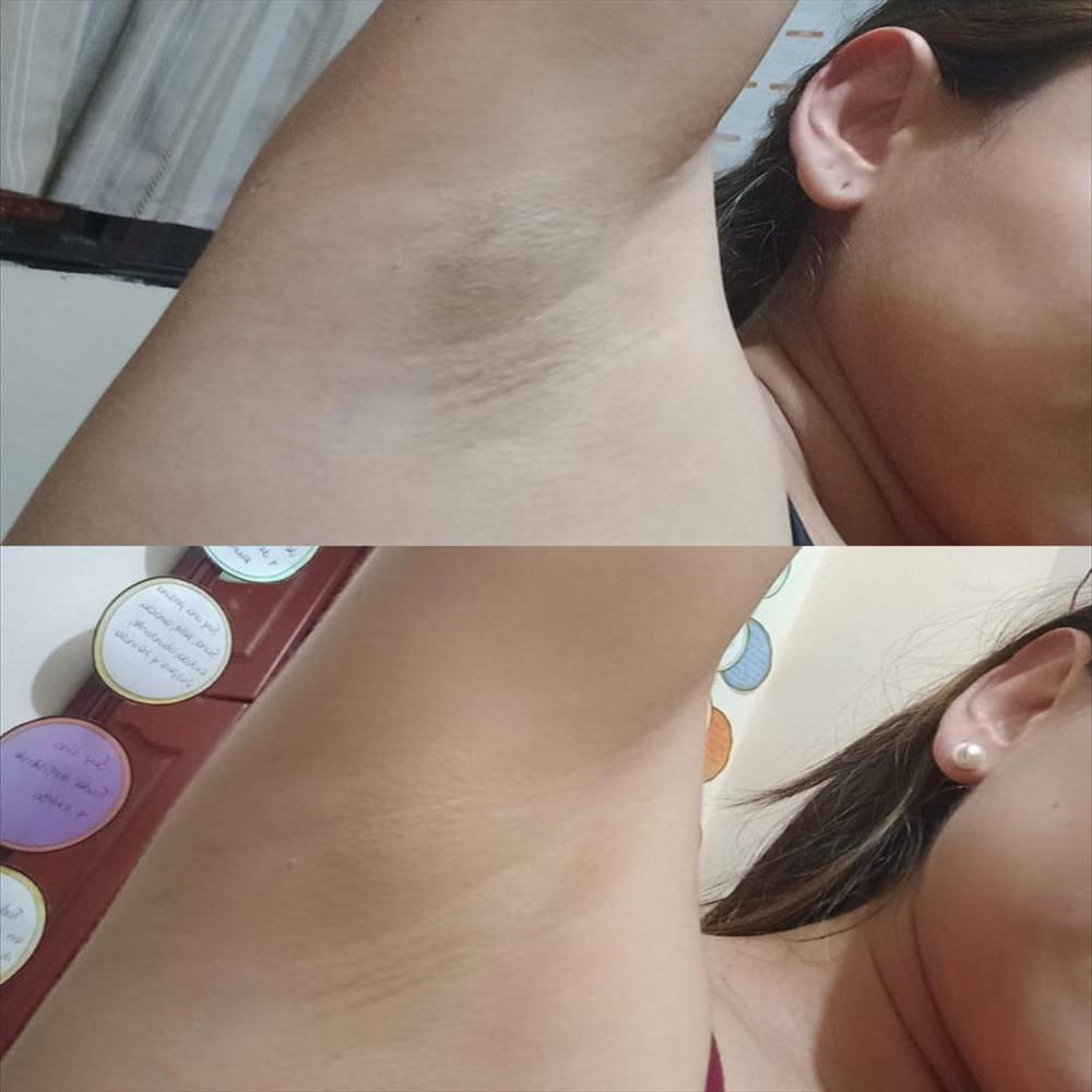 Crema Despigmentante Natural Shine Quita Manchas Zona Intima, Axilas, Codos 60Ml img #4