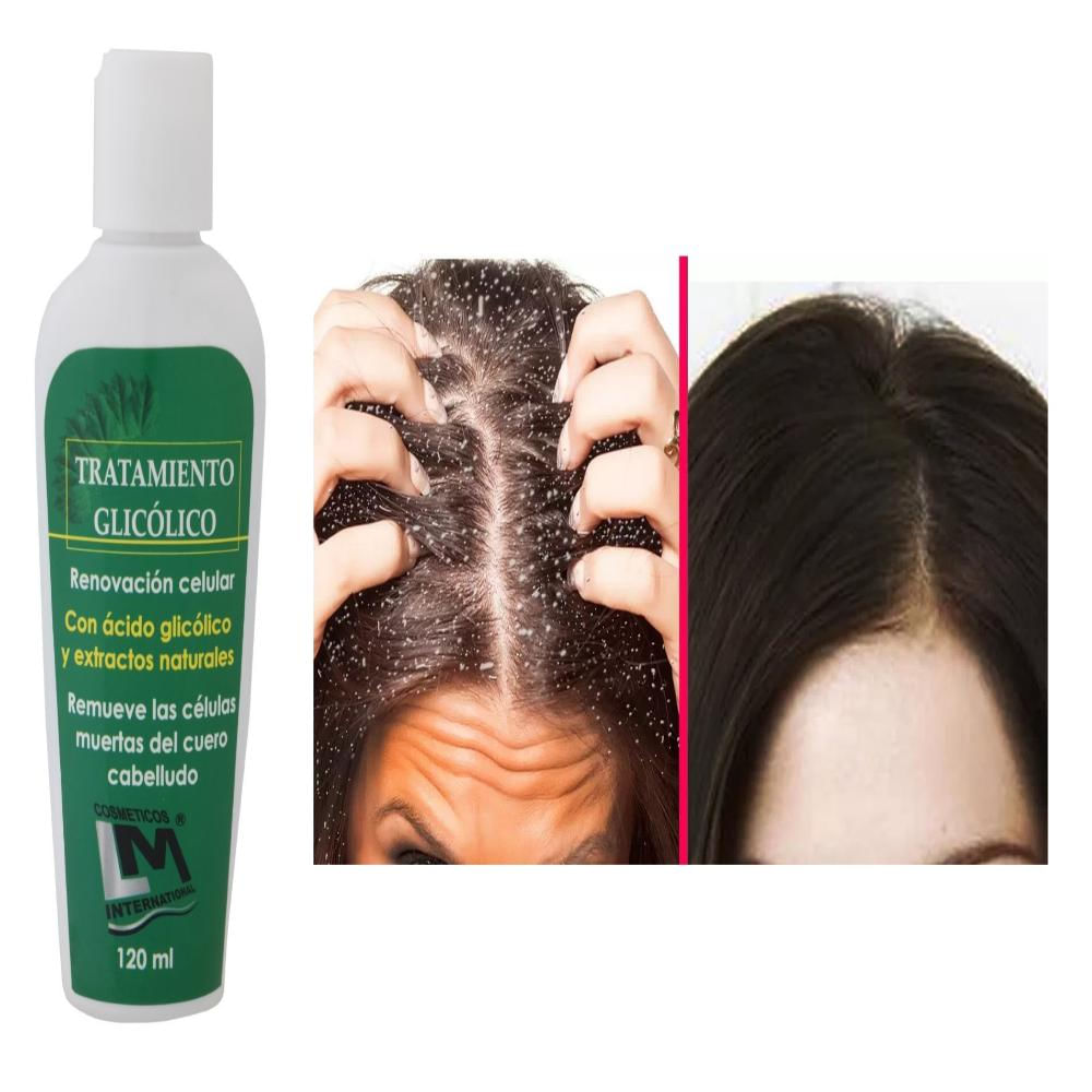 Tratamiento Glicólico Lm Peeling Capilar X120ml img #2