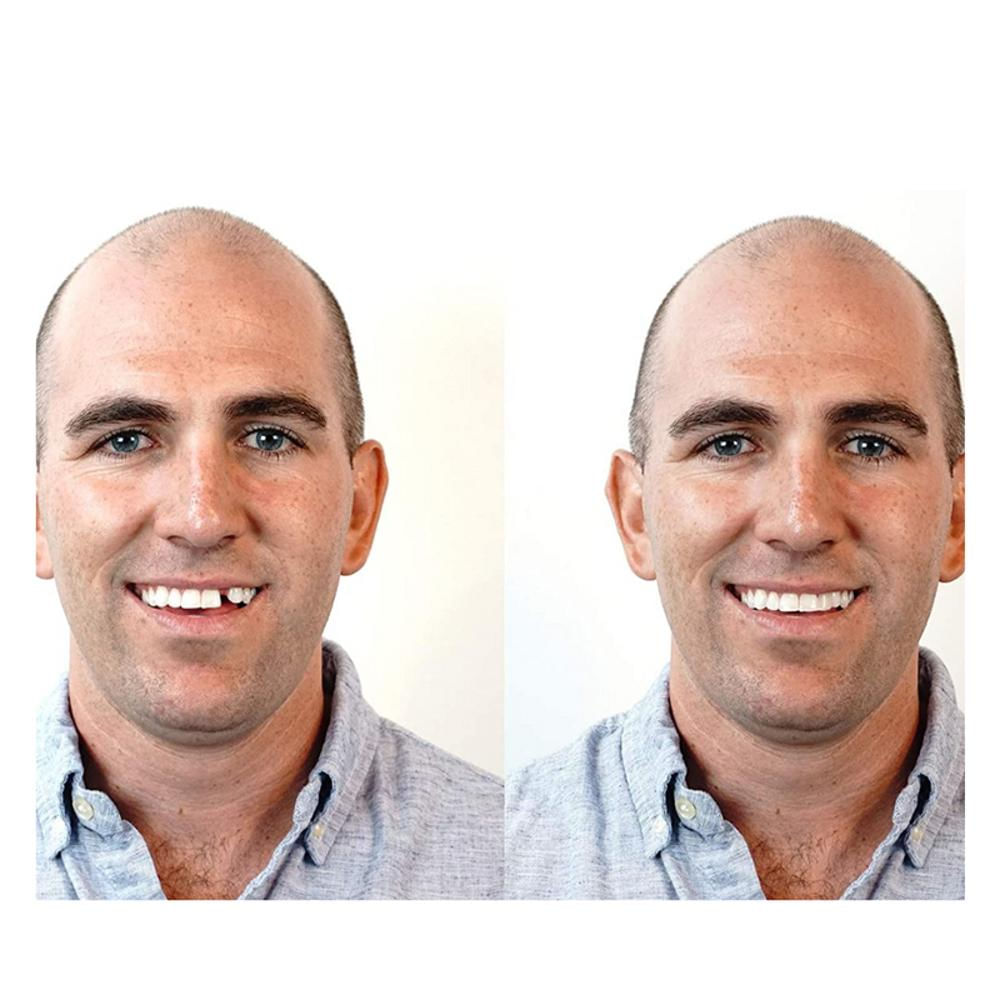 Kit De Reemplazo De Dientes Temporales De Emergencia img #2