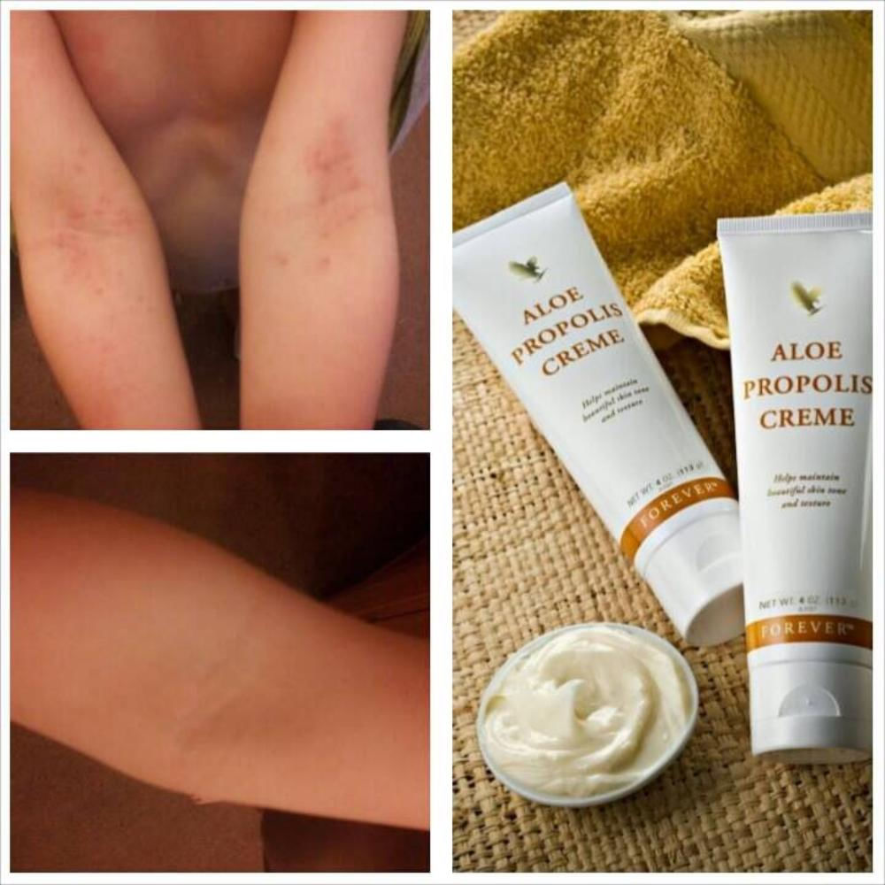 Forever Aloe Propolis Creme® img #2